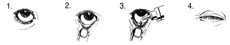 Lumigan-all 4 pictures